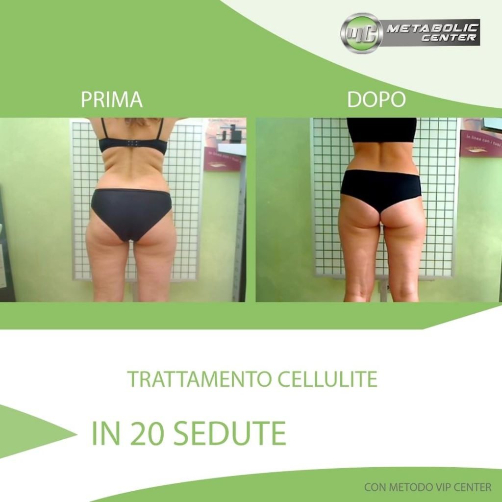 metabolic-prima-dopo-36-1024x1024